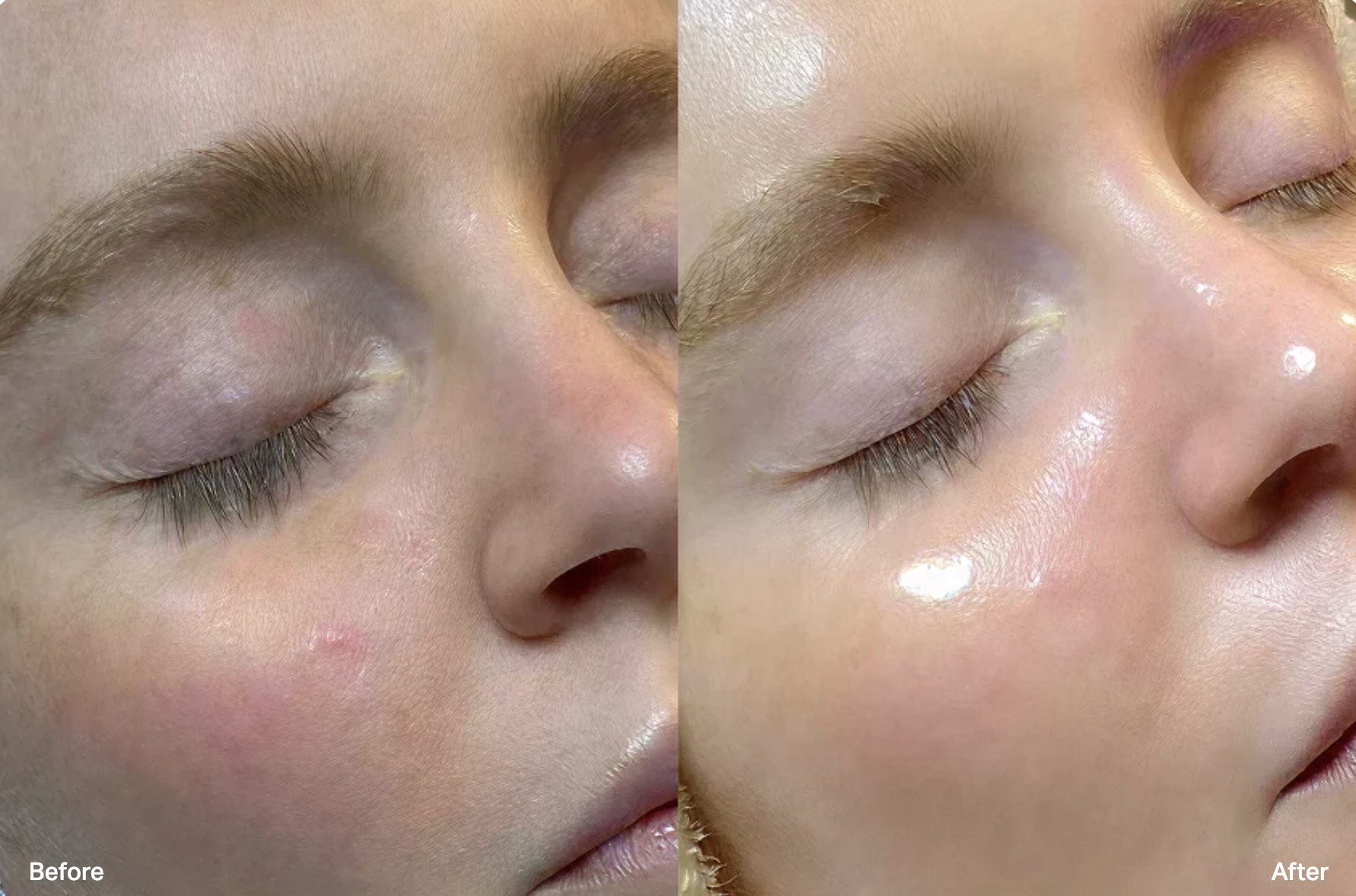 Facials in Palm Beach Gardens at MC Wellness & Spa